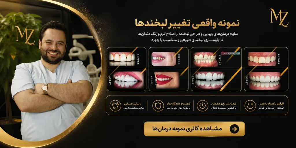 طراحی لبخند در اصفهان