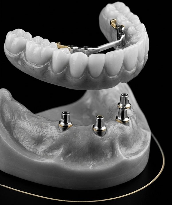 دکتر محسن ضیائی متخصص پروتزهای دندانی در اصفهان