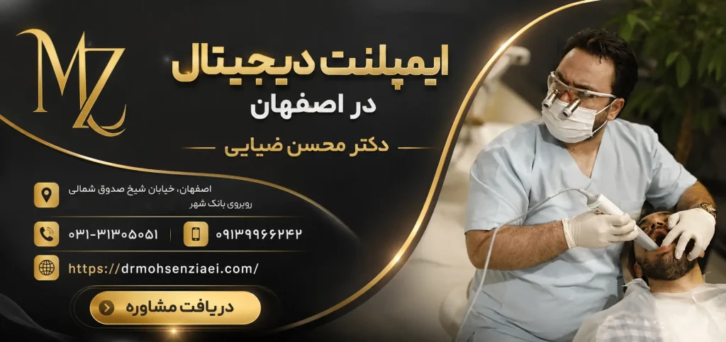 ایمپلنت دیجیتال در اصفهان