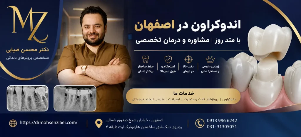 اندوکراون در اصفهان