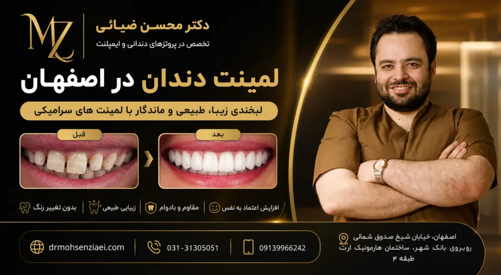 لمینت دندان در اصفهان