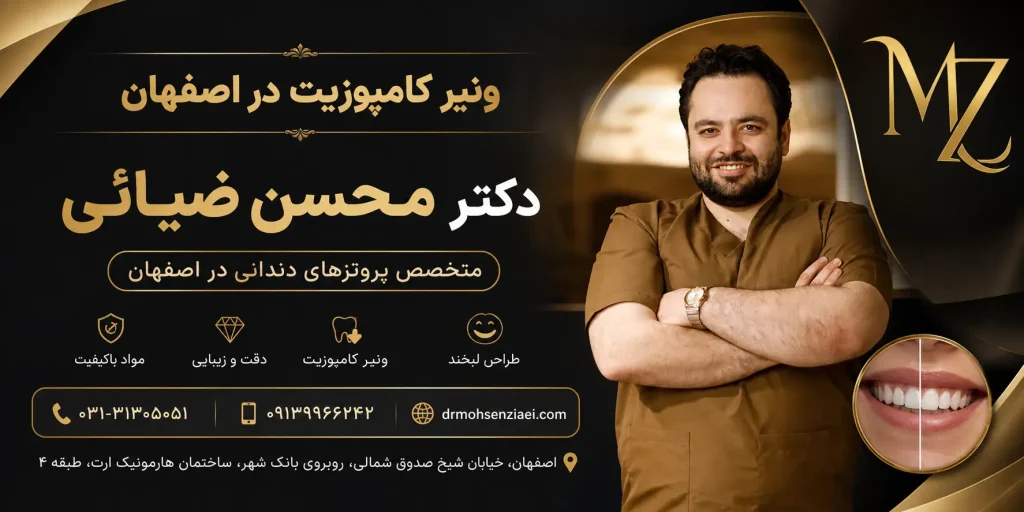 ونیر کامپوزیت در اصفهان