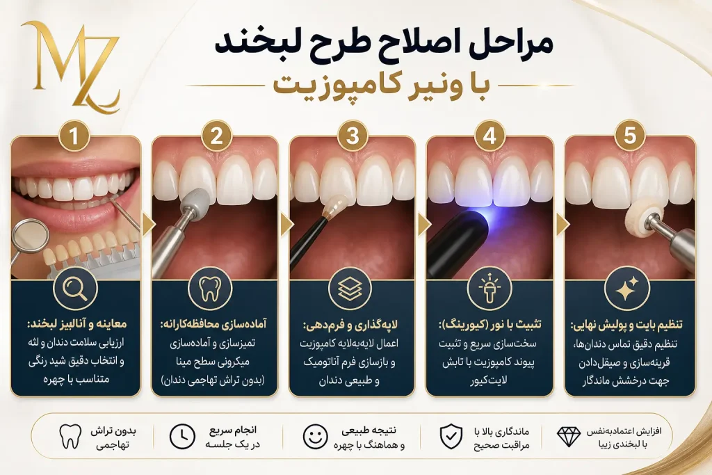 ونیر کامپوزیت در اصفهان