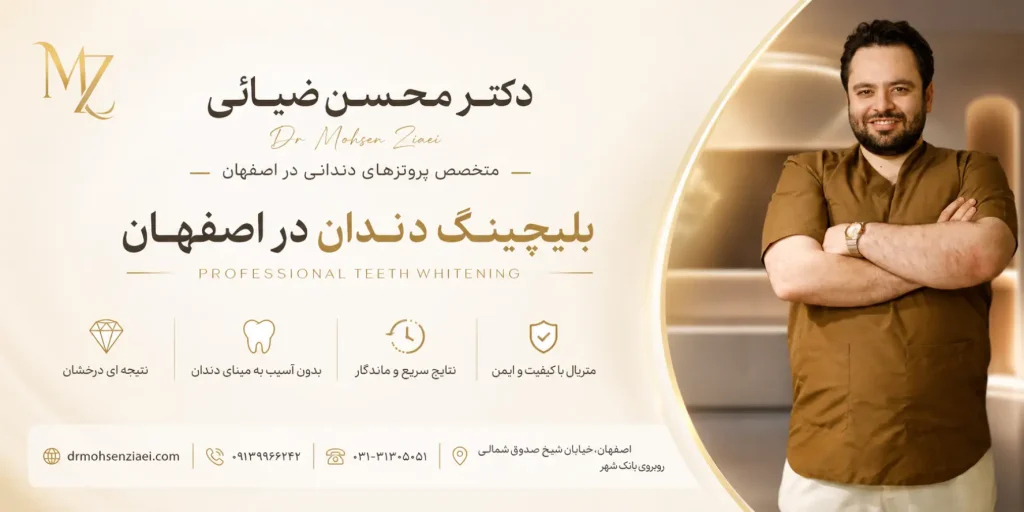 بلیچینگ دندان در اصفهان