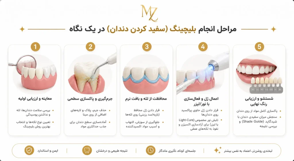 بلیچینگ دندان در اصفهان