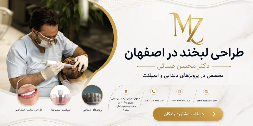 طراحی لبخند در اصفهان