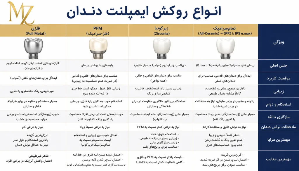 روکش ایمپلنت در اصفهان
