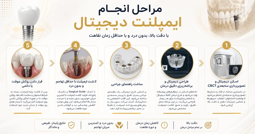 ایمپلنت دیجیتال در اصفهان
