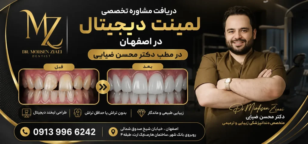 لمینت دندان دیجیتالی یا سنتی؟